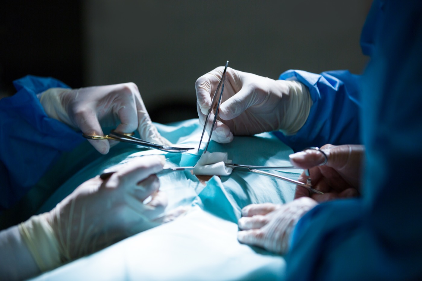 Vasectomy